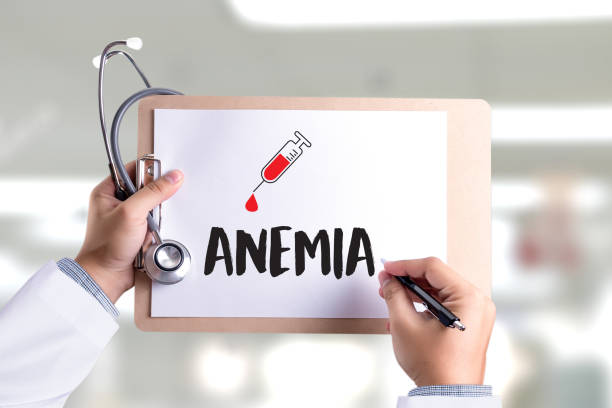 Foto ilustrativa para entenda sobre anemia